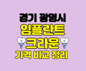경기광명시 임플란트 잘하는곳 썸네일이미지