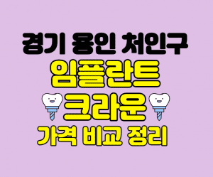 경기용인처인구 임플란트 잘하는곳 썸네일이미지